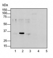Biotin carboxyl carrier subunit of chloroplast ACCase